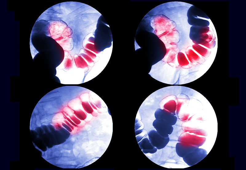 Fluoroscopy